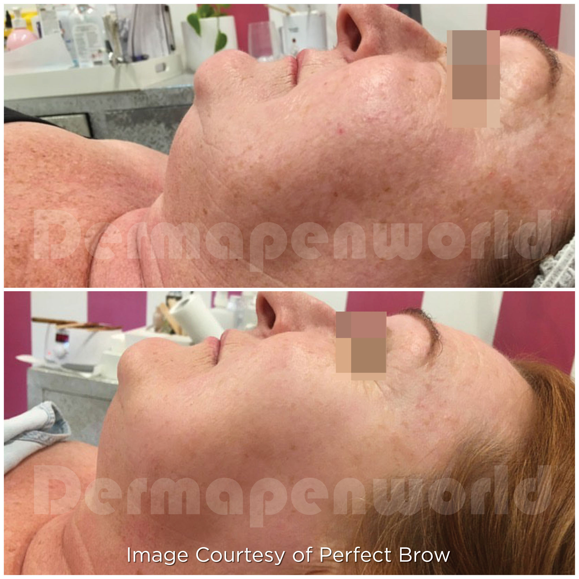 https://www.vitalitybeautybar.com.au/thumbnaillarge/Ageing_Female6.jpg